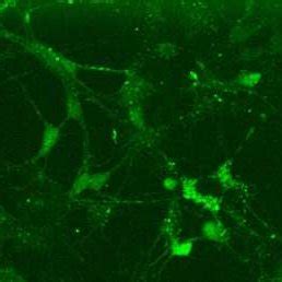 Intracellular Calcium Imaging Representative Image Of Hippocampal Download Scientific Diagram