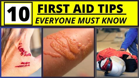 10 First Aid Tips You Must Know Youtube