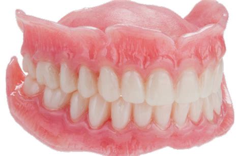 Fixed Complete Denture