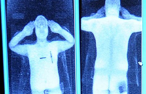 Some Full Body Scanners Not Without Cancer Risk Experts