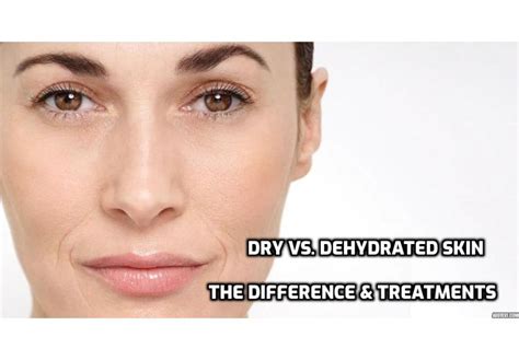 How To Have A Healthy Life Dry Vs Dehydrated Skin Whats The