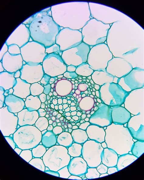Chemically Fixed Cross Section Of A Vascular Bundle Rbotany
