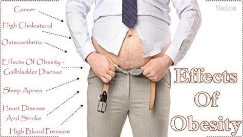 10 Side Effects Of Obesity On The Body You Should Know