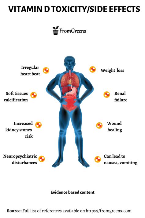 Vitamin D Toxicity Side Effects Evidence Based Content