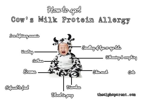 Introducing Dairy To Milk Allergy Infant 26 Symptoms Of Dairy