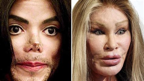 Celebrity Plastic Surgery Blog Plastic Surgery Among Young People