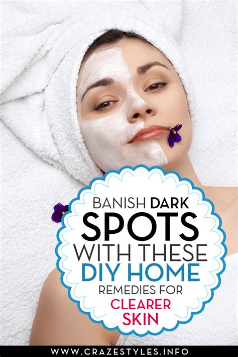 Banish Dark Spots With These Diy Home Remedies For Clearer Skin Skin