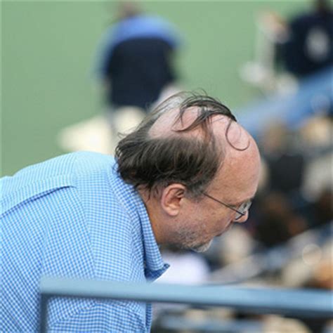 Start studying bro yo hairline ugly. 13 Ugliest Hairstyles of Our Time - Grandparents.com