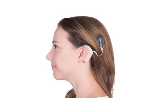 Was Ist Ein Cochlea Implantat Und Wer Benötigt Es Magazinhören