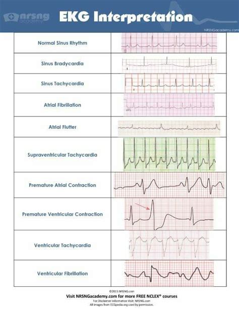Ekg Interpretation Cheat Sheet EKG ECG Cheat Sheet Nursing Tips