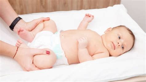 displasia de caderas en los bebés qué es diagnóstico y tratamientos