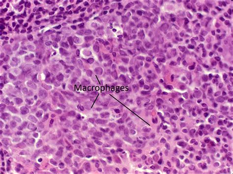 Macrophage Histology