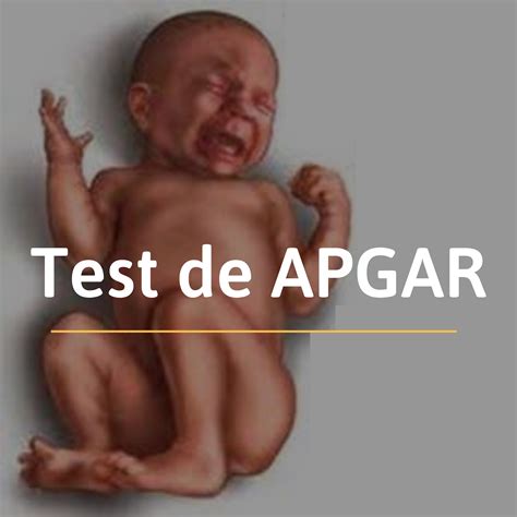 El Test De Apgar Actualizado Octubre 2023