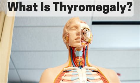 Thyromegaly Symptoms Causes Types Treatment Medication And