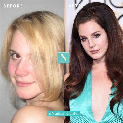 From Lizzy Grant To Lana Del Rey What Do You Think Of Lanas Transformation Is It Still The