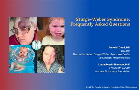 Sturge Weber Syndrome Vascular Birthmarks Foundation
