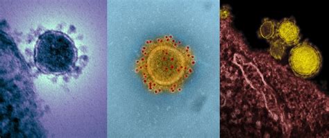 Preguntas Y Respuestas Sobre El Nuevo Coronavirus Procedente De China