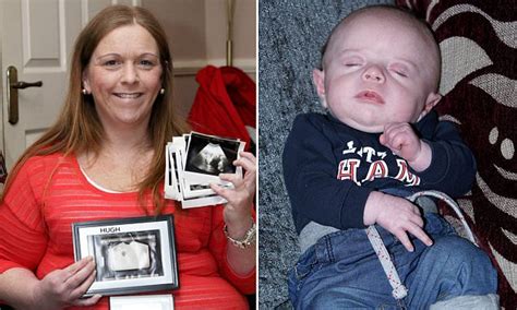 Woman Born With Two Wombs And Two Vaginas Gives Birth To A Miracle Baby Daily Mail Online