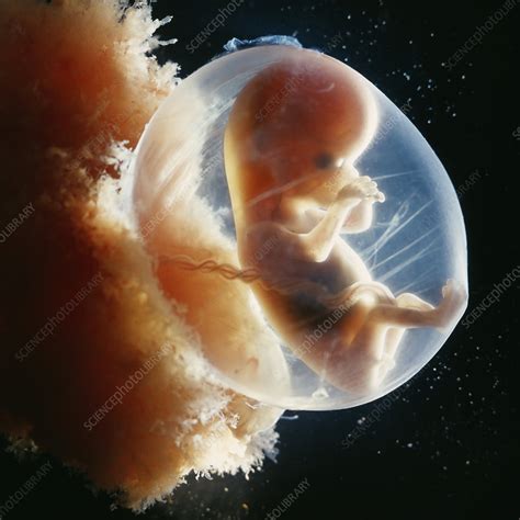 Foetus In Amniotic Sac 16 Weeks Stock Image C0487982 Science