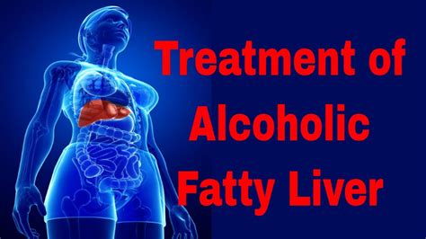 Treatment Of Alcoholic Fatty Liver Disease Youtube