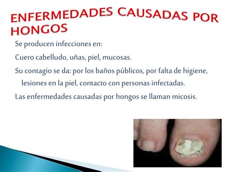 Ppt Hongos En La Salud Humana Powerpoint Presentation Free Download
