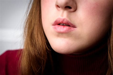 5 Cara Mengatasi Bibir Kering Dengan Bahan Alami Yang Super Mudah