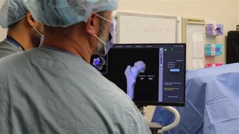 Robot Assisted Hip Replacement Surgery At Windsor Regional Hospital A First In Ontario Cbc News