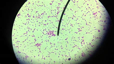 Gram Alfa Haemolytic Streptococcus Youtube