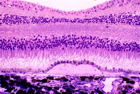 Shows A Histological Section Through The Foveal Druse Of Figures 1a And