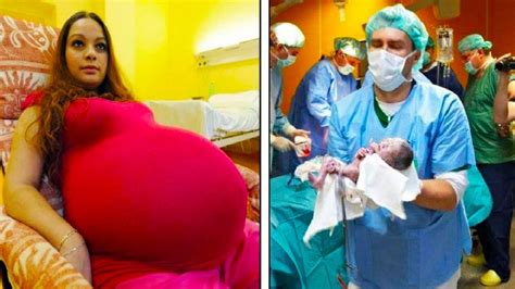 mom thinks she s having twins but drs quickly learn she s making history with rare delivery