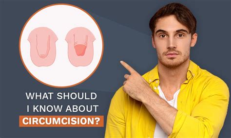What You Need To Know About Circumcision