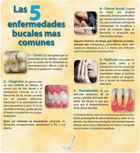 Las Enfermedades Bucales M S Comunes Higiene Bucodental Caries