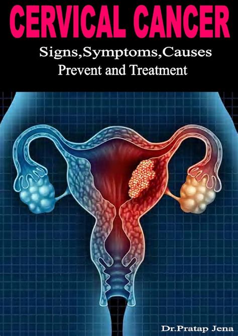 Cervical Cancer Signs Symptoms Causes Prevent With Treatment Payhip