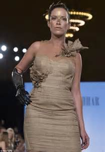 The Bionic Model Model With Prosthetic Arm Takes Runway By Storm At
