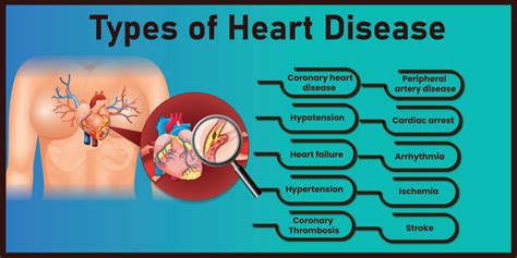 Heart Disease Causes Prevention And Treatment