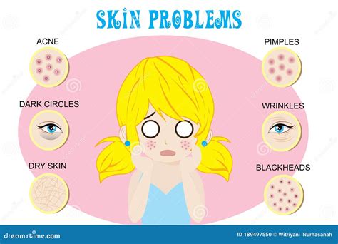 Common Skin Diseases Vector Illustration 42749056
