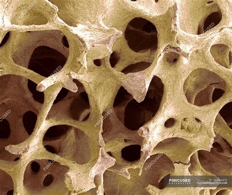 Cancellous Bone Tissue Scanning Electron Microscope Normal Stock
