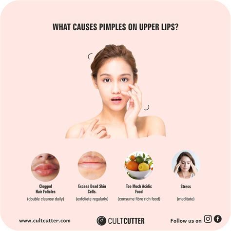 What Causes Pimples On Upper Lips In 2021 What Causes Pimples Upper