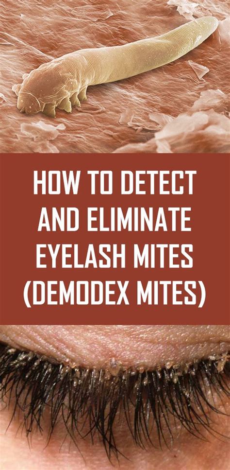 How To Detect And Eliminate Eyelash Mites Demodex Mites Eyelash