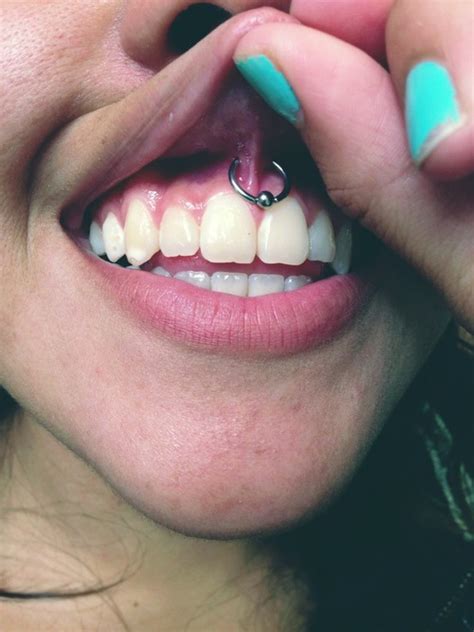 Septum And Top Lip Piercings With Silver Studs