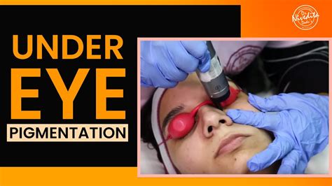 Laser Treatment For Dark Circles Under Eyes Under Eye Pigmentation