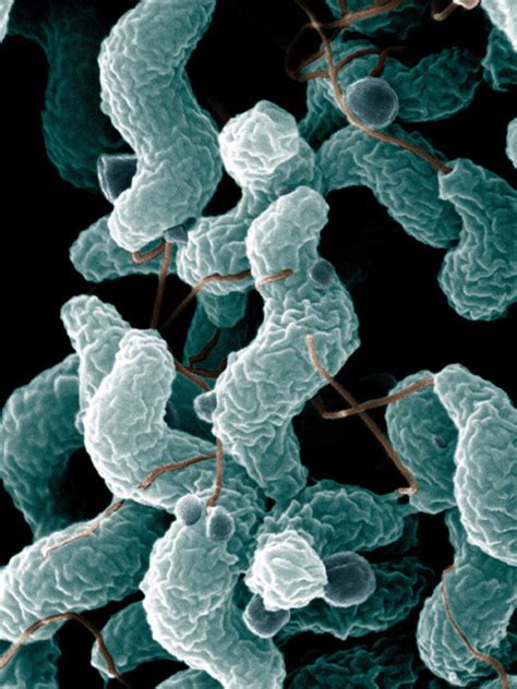 Campylobacter Bakterien Rem Koloriert Doccheck