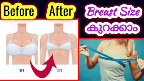 ബരസററ സസ കറകക6 Simple Exercises Tips To Reduce Breast