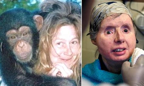 chimp attack victim charla nash talks about wonders of her face transplant daily mail online