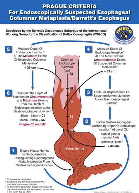 diagnosis of barrett s esophagus abdominal key