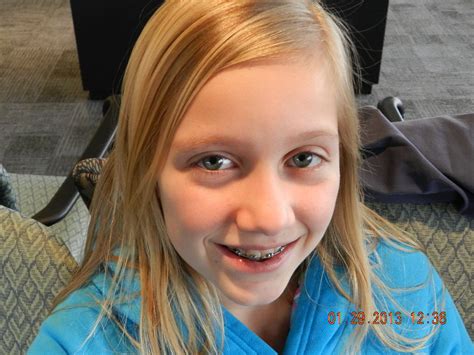 Maddyjust Before Her Dental Surgery To Remove 4 Teeth