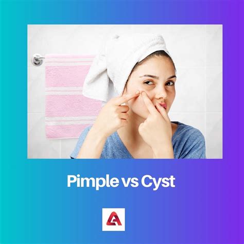 Pimple Vs Cyst Difference And Comparison