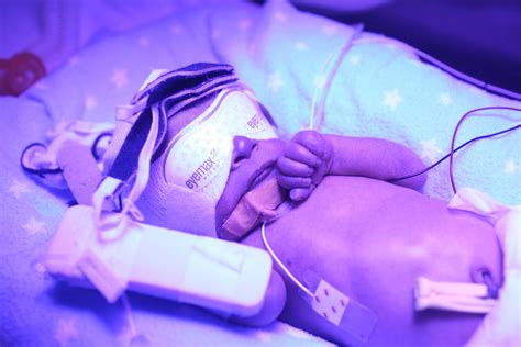 They'll be able to assess whether treatment is needed. Bilirubin Levels and Jaundice Risks and Treatment
