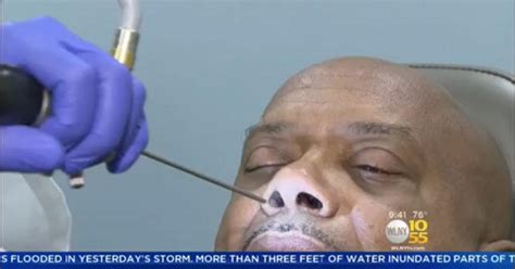 Health Watch Man S Runny Nose Was Actually Leaking Brain Fluid Cbs New York