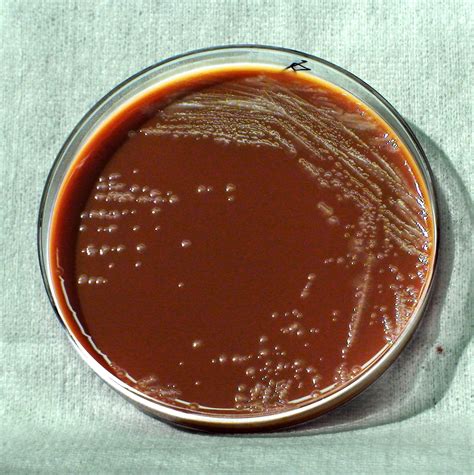 Free Picture Gram Negative Yersinia Pestis Bacteria Grown